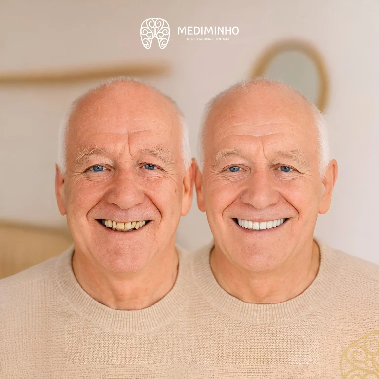 Antes e depois de reabilitação oral completa com implantes dentários na Clínica Mediminho em Braga