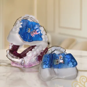 Aparelhos ortodônticos intercetivos infantis — soluções personalizadas que guiam o crescimento e corrigem alterações precoces, disponíveis na Mediminho em Braga.